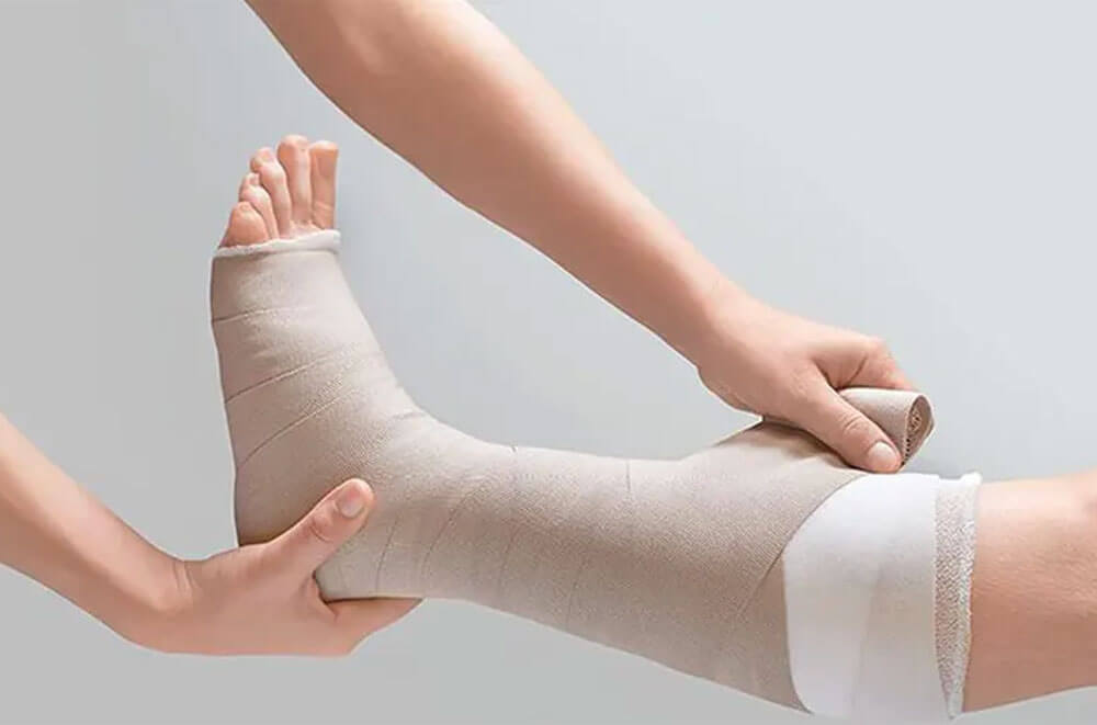 Lenfödem bandaj uygulaması